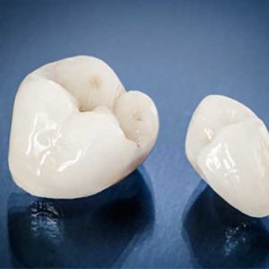 Image of dental crown